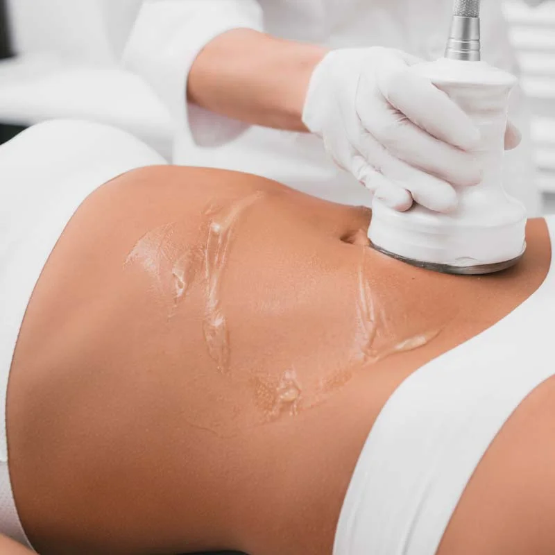 Terapi Slimming Fat